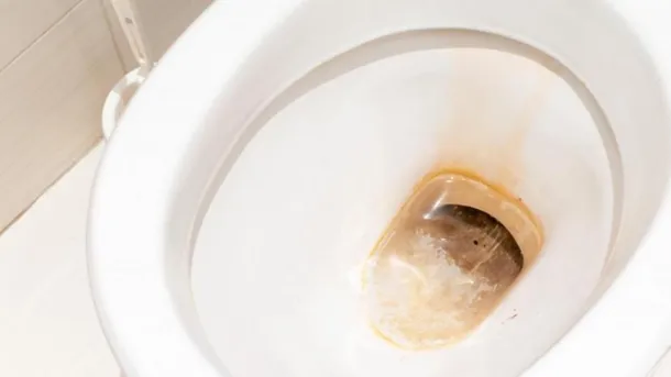 multimedia.normal.a82c2f0a5dda5e72.aW5vZG9yby1tYW5jaGEtbWFycm9uanBnX25vcm1hbC53ZWJw