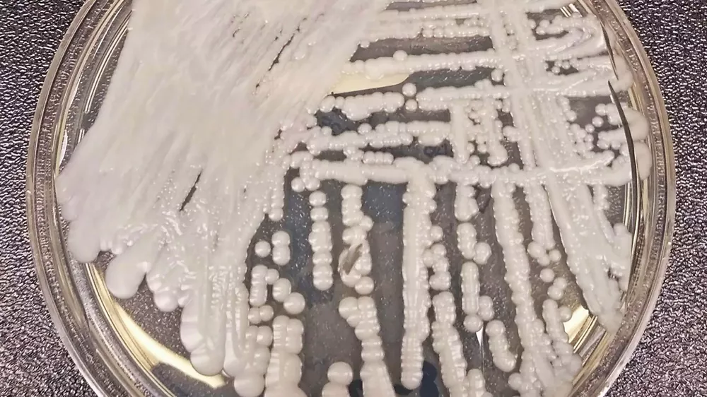 4APBKTUY6BBWHBURK36UEWEKEU