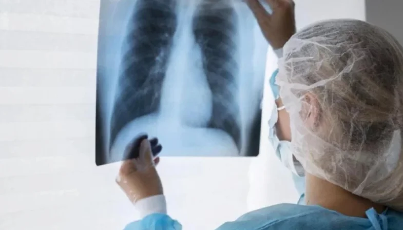 radiografia