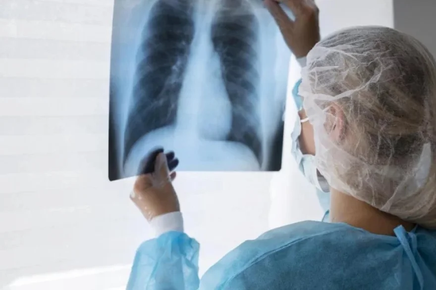 20260919144103_tuberculosis